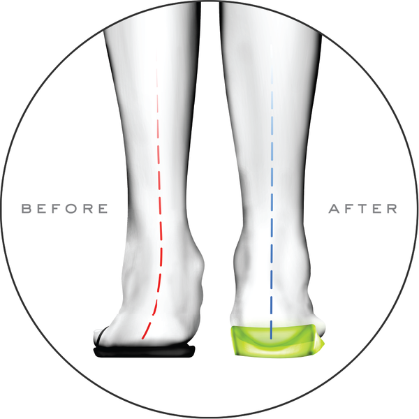 What are Orthotic Insoles and why should you use them?